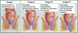 Tanaman Liar Obat Ambeien