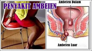 Buah Obat Wasir Alami